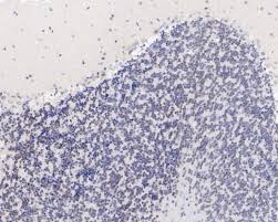 Primary and Secondary Antibodies