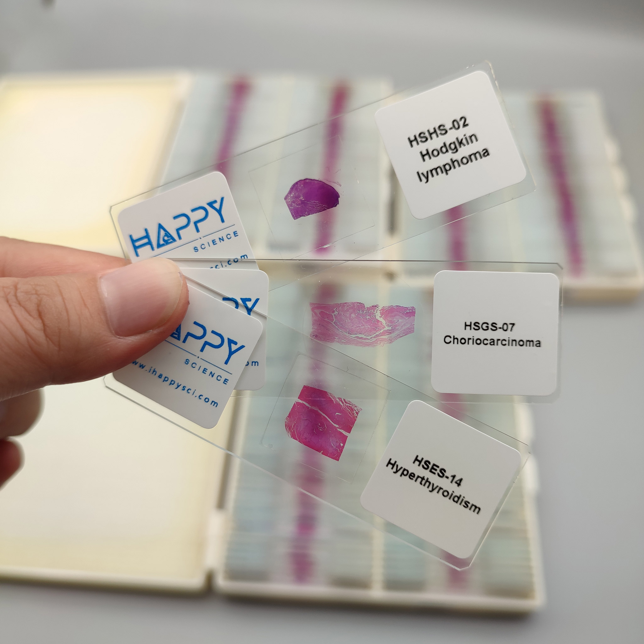Human Pathology Slides - Prepared Microscope Slides Individual