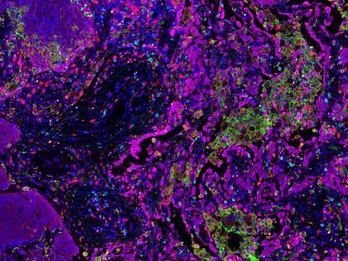 Opal 6-Plex Detection Kits - for Whole Tissue Slide Imaging (formerly Opal Polaris 7 Color IHC Detection Kits)