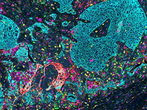 Opal 6-Plex Detection Kits - for Field of View Imaging (formerly Opal 7-Color IHC kits)