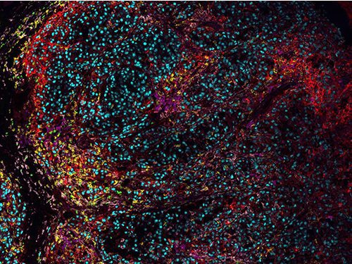 Opal 3-Plex Detection Kits (formerly Opal 4-Color IHC kits)