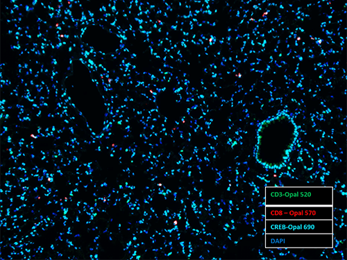 Opal 3-Plex Anti-Rb Detection Kits (formerly Opal 4-Color Anti-Rabbit IHC Kits)