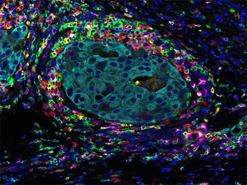 Solid Tumor Immunology 6-Plex Panel (formerly Opal 7 Solid Tumor Immunology Kit)