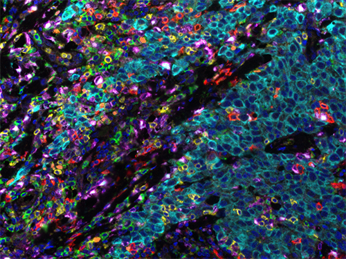 Tumor Infiltrating Lymphocyte 6-Plex Panel (formerly Opal 7 Tumor Infiltrating Lymphocyte Kit)