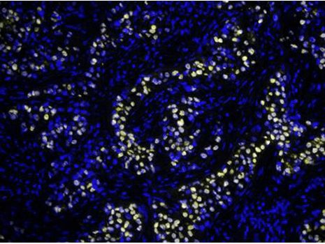 TSA Plus Cyanine 3.5