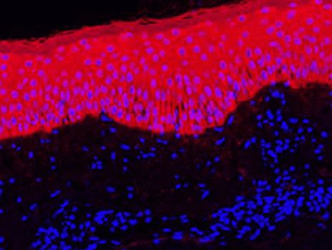 TSA Plus Cyanine 5.5
