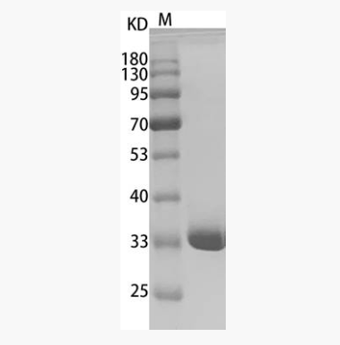 Human Annexin V/ANXA5 Protein