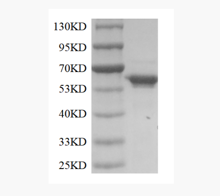 Terminal Deoxynucleotidyl Transferase (TdT)