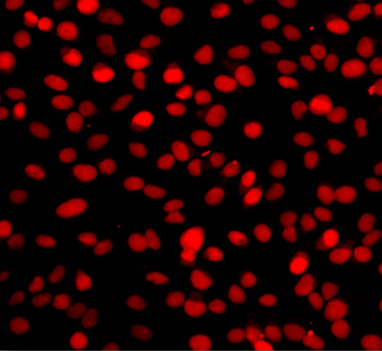 One-step TUNEL Apoptosis Assay Kit (Orange Fluorescence)