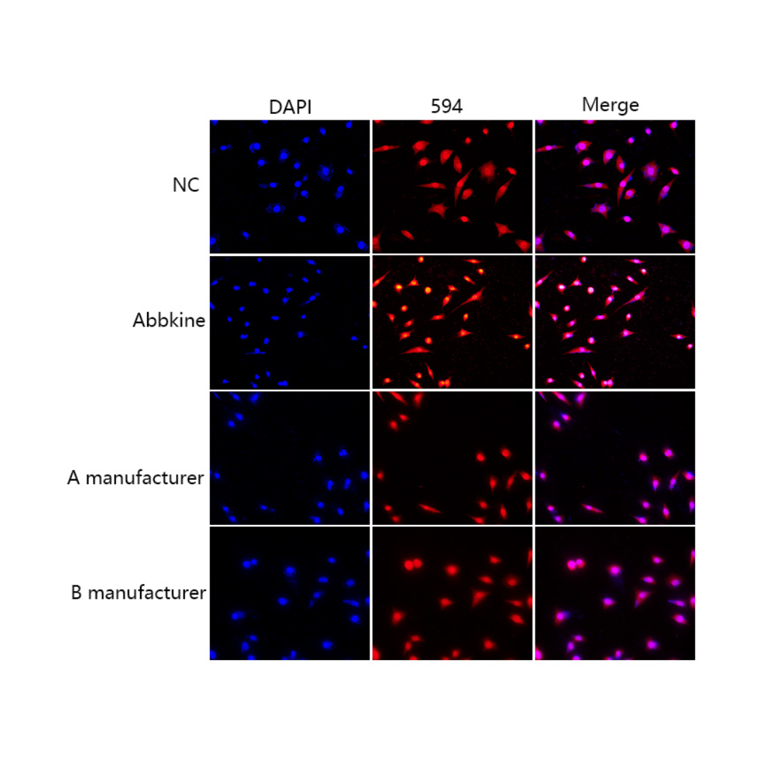 SuperKine™ Enhanced Antifade Mounting Medium
