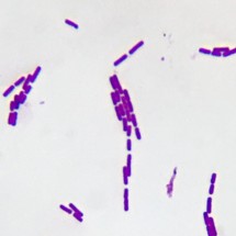 Microbiology Slides - Prepared Microscope Slides Individual